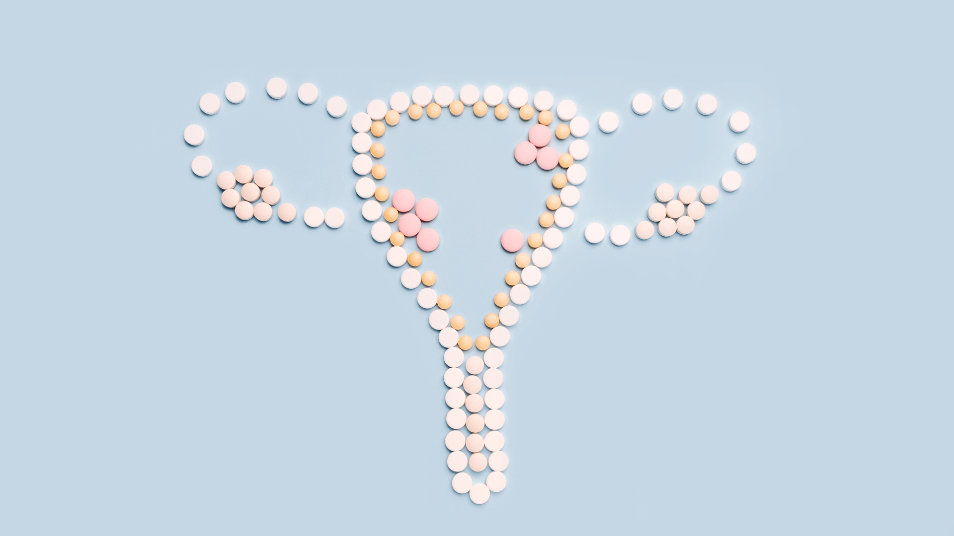 Acupuncture treatment for Endometriosis