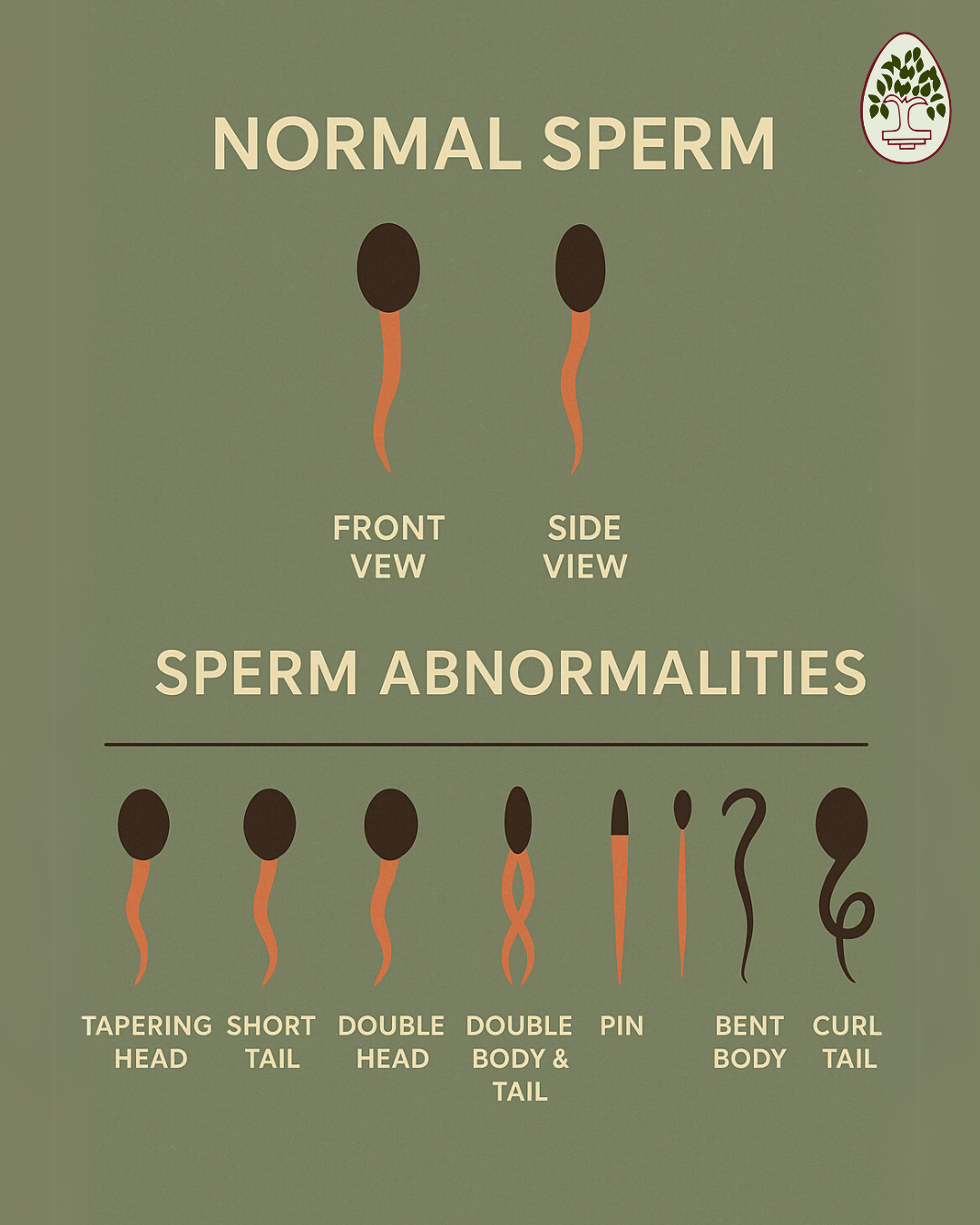 SPERM