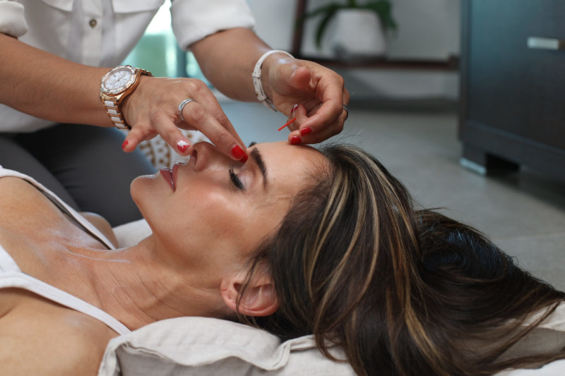 Woman receiving cosmetic acupuncture.